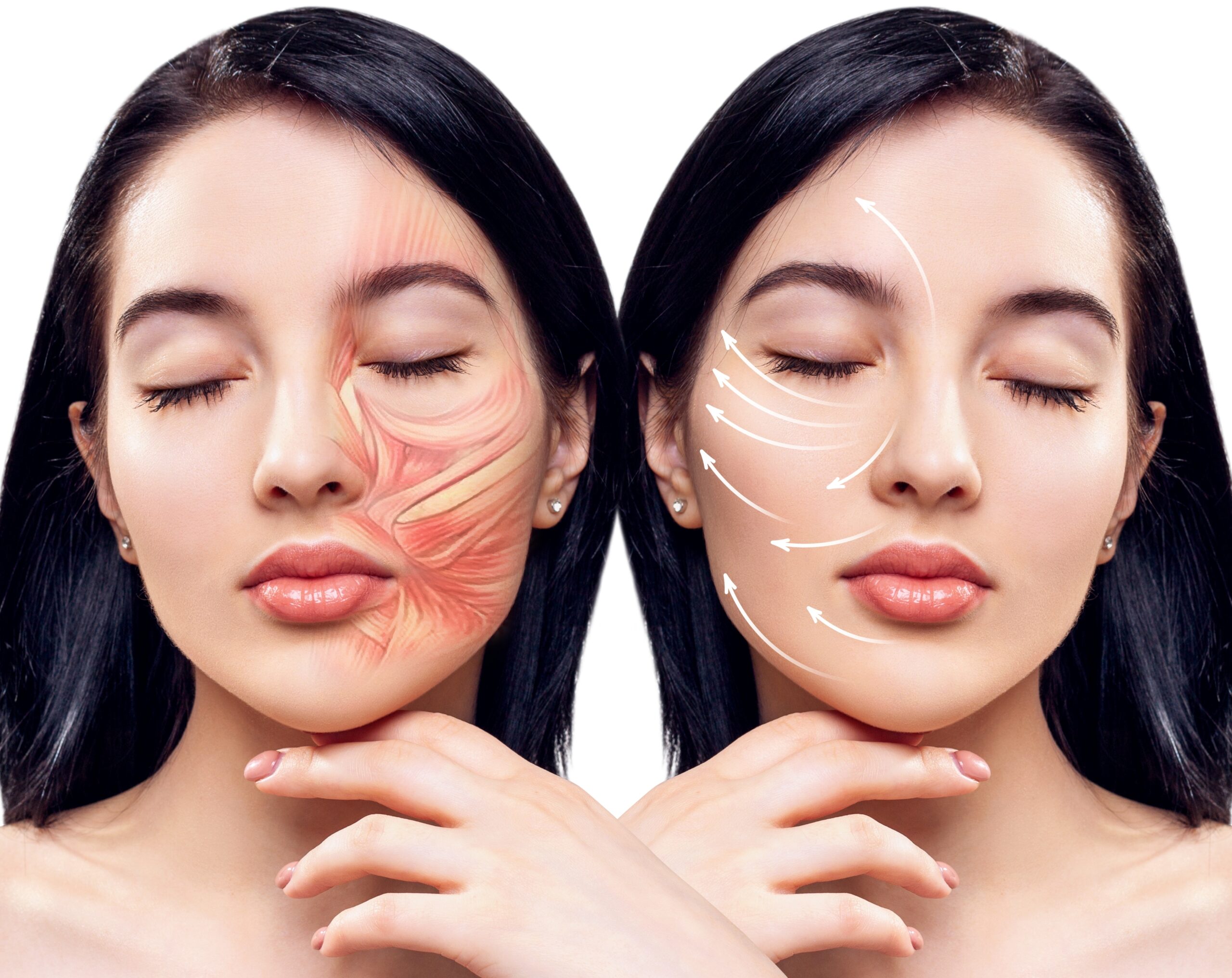 Anatomia da Face para Realização de Procedimentos Estéticos com Segurança